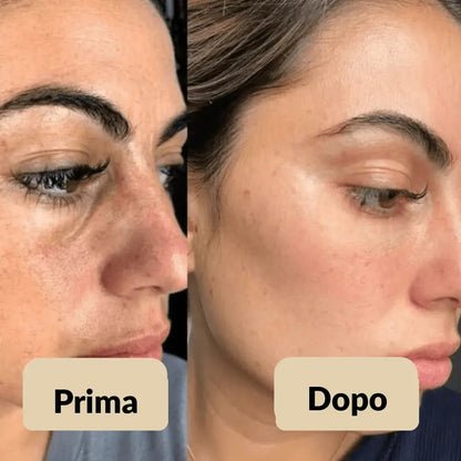 Peel Shot Elimina le impurità - Glynea™