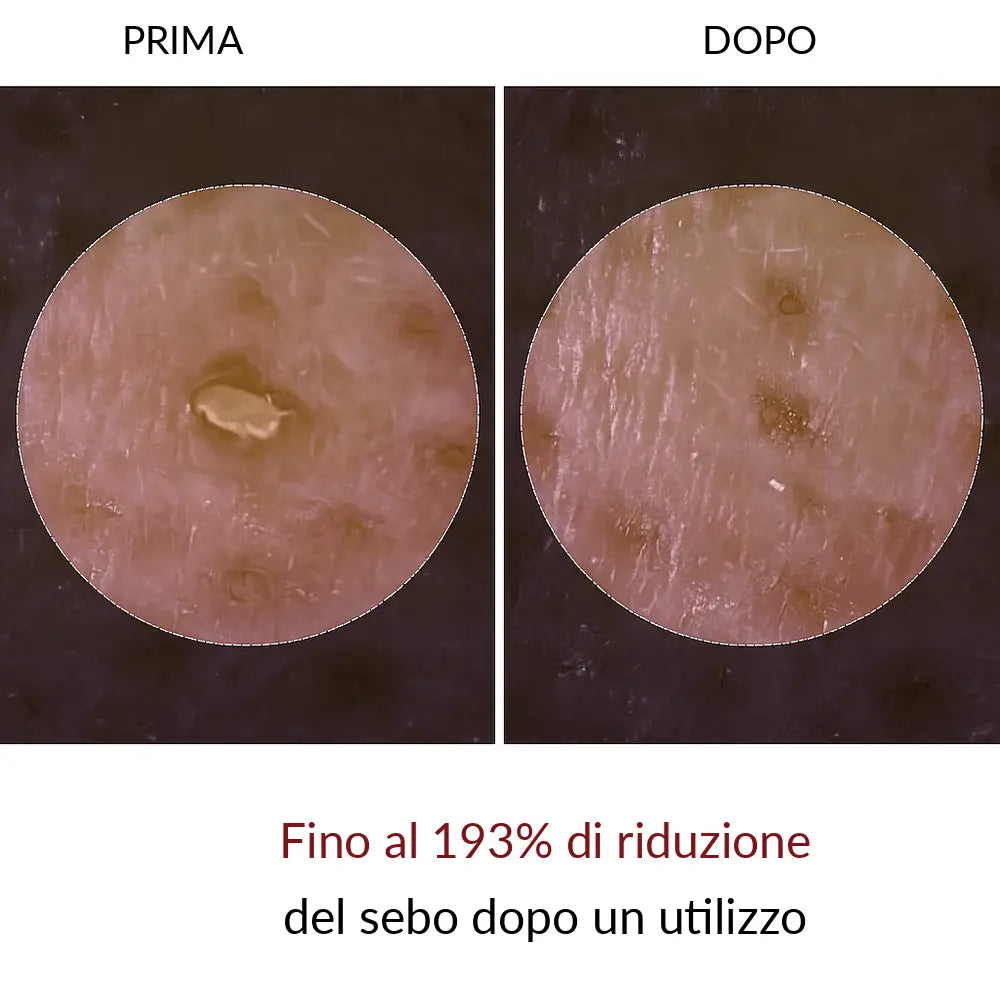 Peel Shot Elimina le impurità - Glynea™